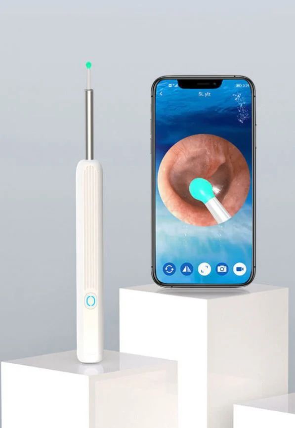 Wireless Earwax Removal Camera Kit – HD Otoscope with Type-C Charging, 3.6mm Lens, Android & iOS Compatible