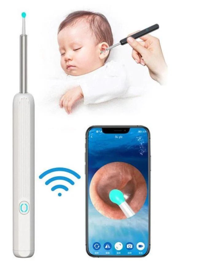Baby being examined with a device, smartphone showing ear inspection app, and device on white background.